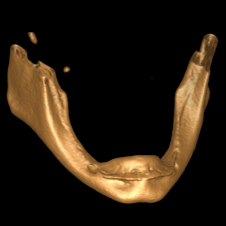 wflGaepreop3D.jpg